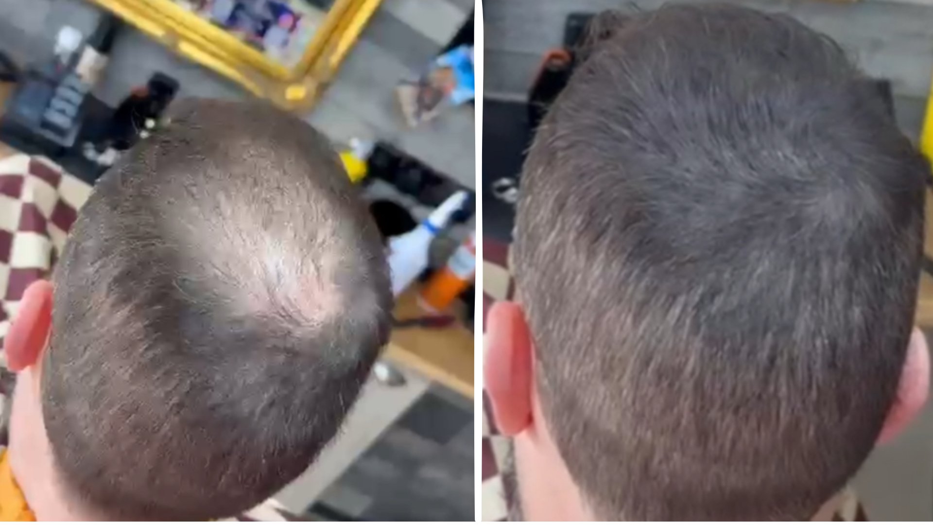 Before and after using Krowned hair density powder
