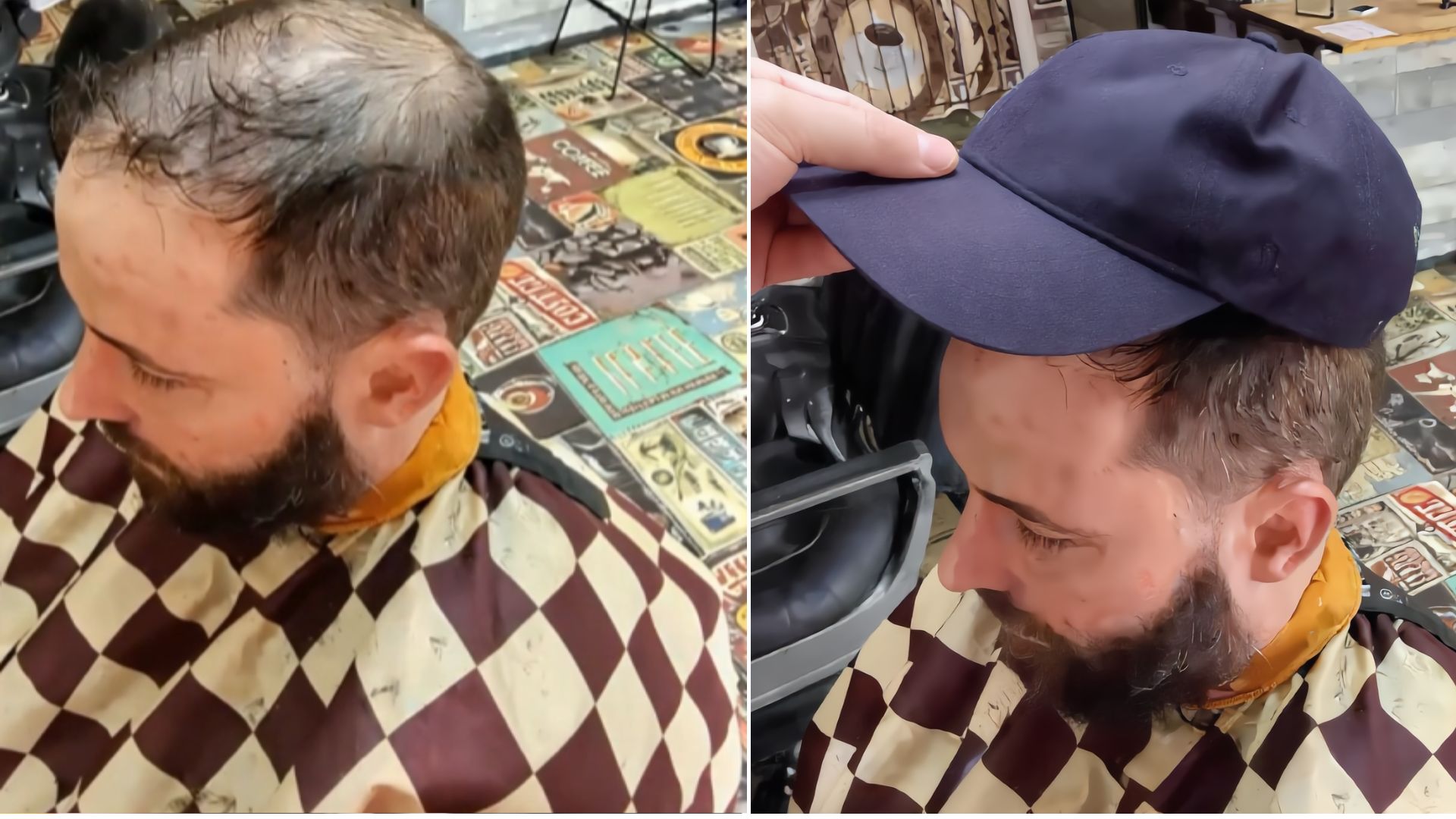 Before and after thinning hair at barbershop